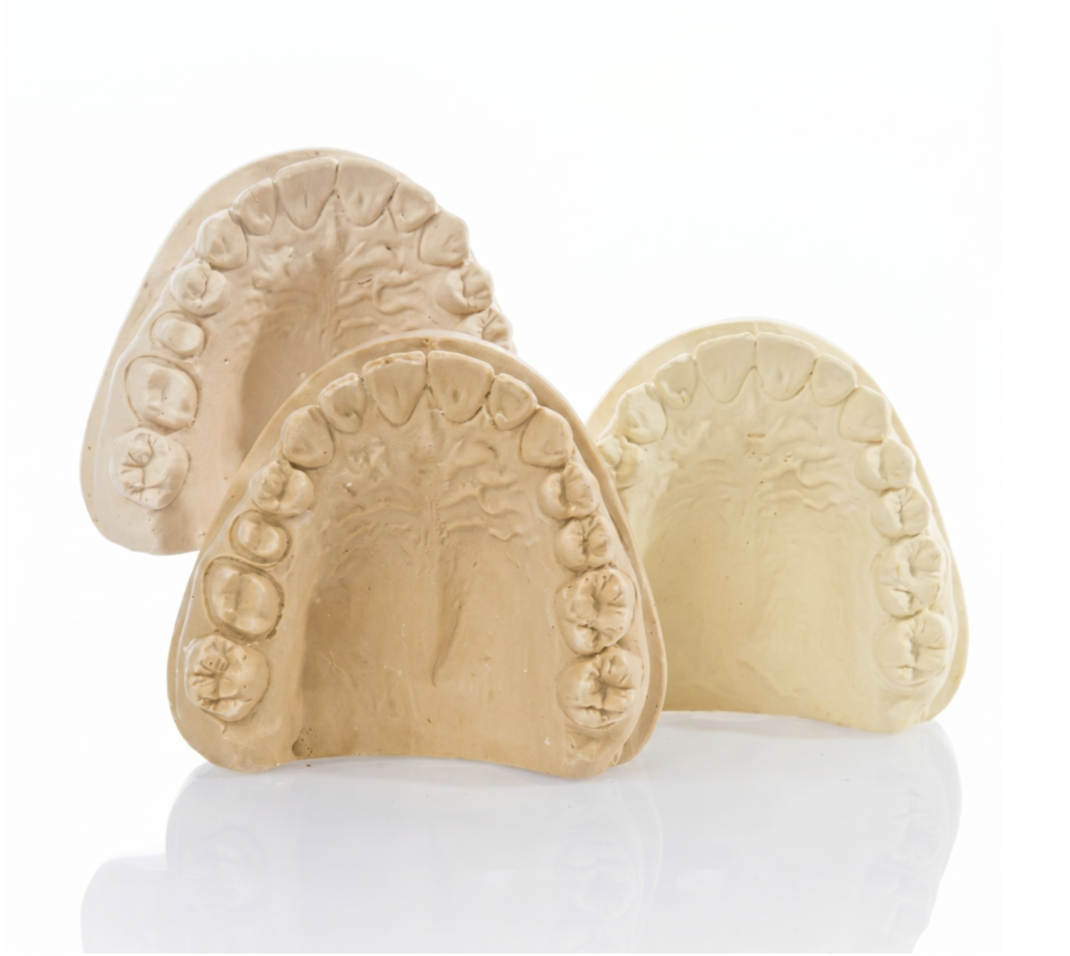 Kalabhai Ultra Rock Die (Brown) Stone (3kg) | DentalMart - view 2